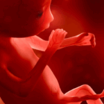 Voorliggende placenta of placenta previa
